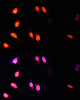 SETD2 Antibody