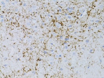 NPY Antibody