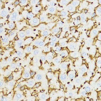 YKL-40 / CHI3L1 Antibody