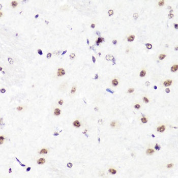 H3R2me2a Antibody