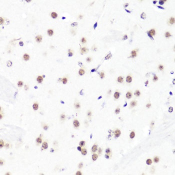 H3R2me2a Antibody