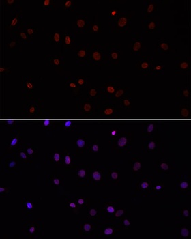 H3R2me2a Antibody