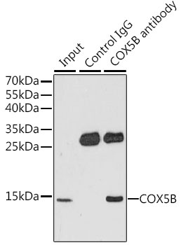 H3R26me2s Antibody