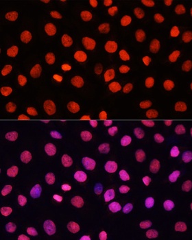 H3R17me1 Antibody