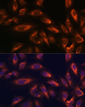 SSTR2 Antibody