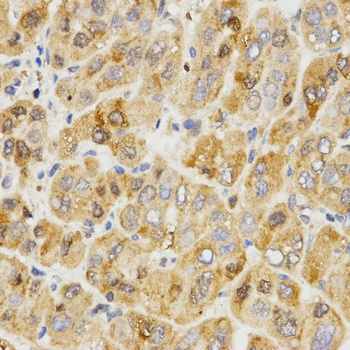 TPM2 Antibody