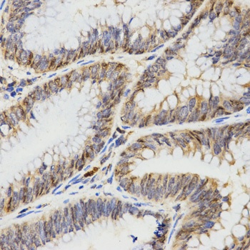 TPM2 Antibody