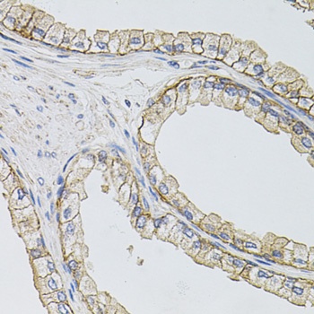 SLC1A4 Antibody