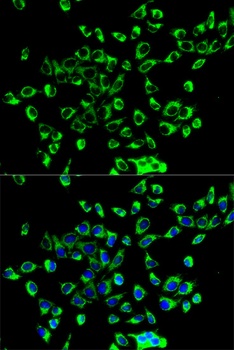 PRDX3 Antibody