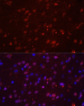 GRIN2B Antibody