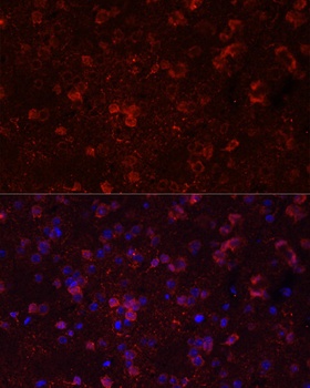 GRIN2B Antibody