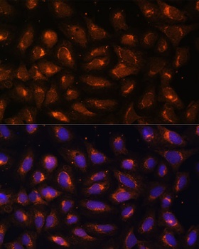 CKMT1B Antibody