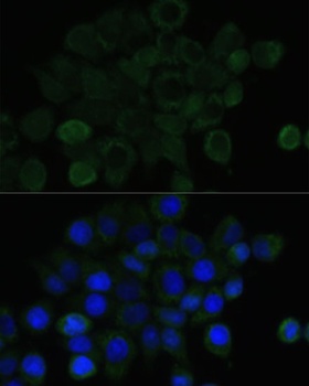 E-Cadherin Antibody