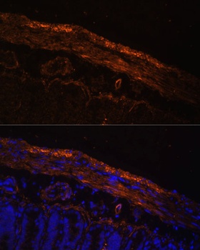 MYL9 Antibody
