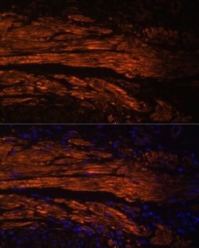 MYL9 Antibody