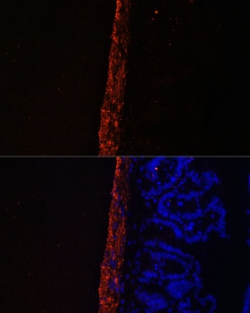 MYL9 Antibody
