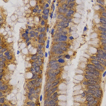 MMP25 Antibody