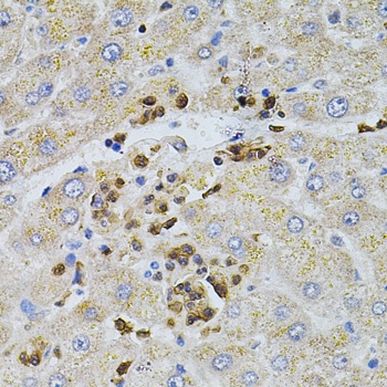 BEST1 Antibody