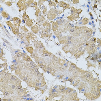 BEST1 Antibody