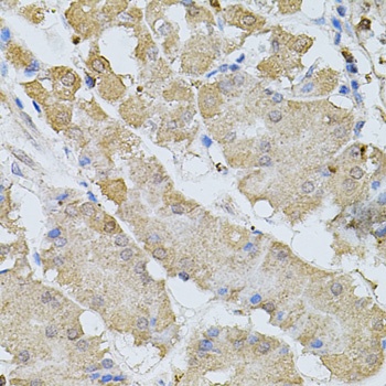 BEST1 Antibody