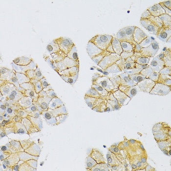 MCT1 Antibody