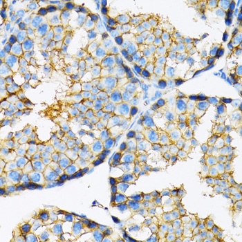 SLC16A1 Antibody