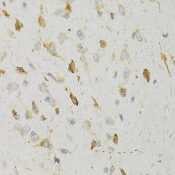 KISS1R Antibody