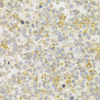 KISS1R Antibody
