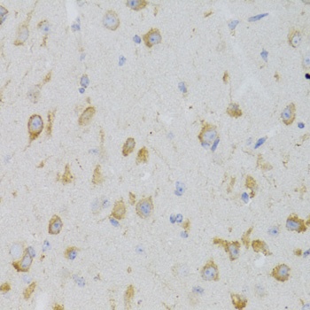 KISS1R Antibody