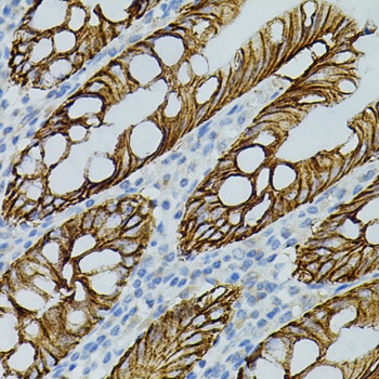 CLDN3 Antibody