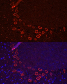 SLC1A1 Antibody