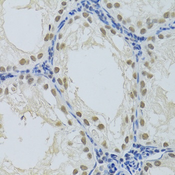 DDB1 Antibody