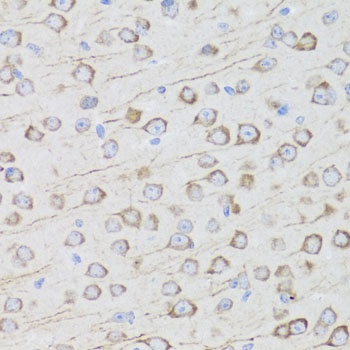MIP Antibody