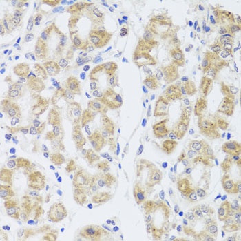 MIP Antibody