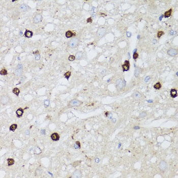 MIP Antibody