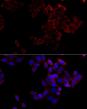Bcl2 Antibody