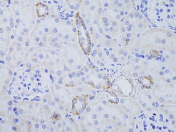 AQP3 Antibody