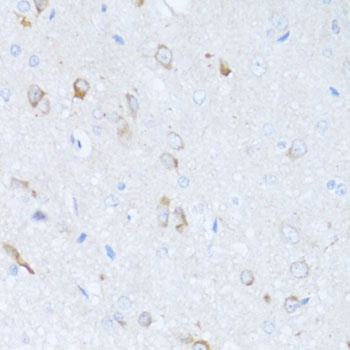 SERPINA3 Antibody