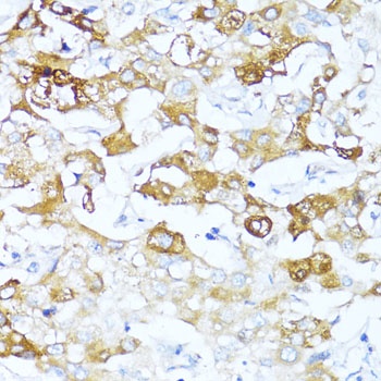 SERPINA3 Antibody