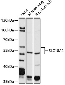 SLC18A2 Antibody