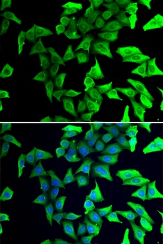 VSNL1 Antibody