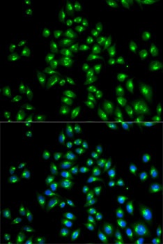 USO1 Antibody