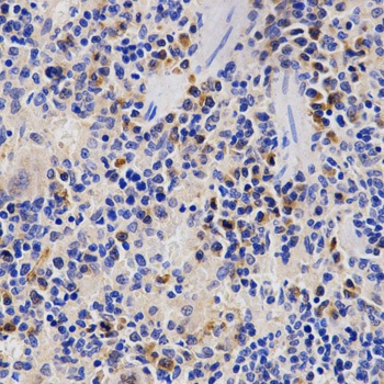 PSMD3 Antibody