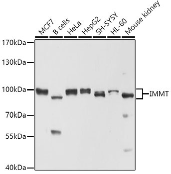 IMMT Antibody