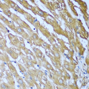 IGF2BP3 Antibody