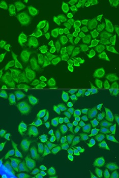IGF2BP2 Antibody