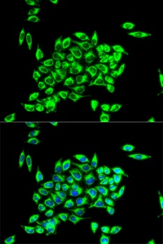 TRAP1 Antibody