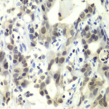 E2F6 Antibody