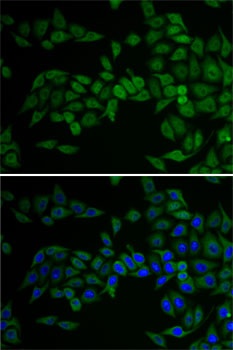 E2F6 Antibody