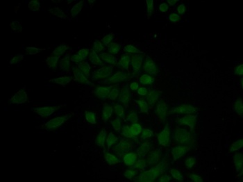 CTSE Antibody